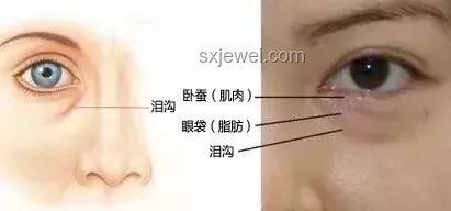 王安宇眼睛问题解决方案：改善视力与眼部健康